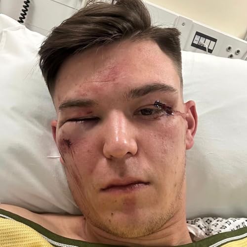 Podcast: Driver reportedly attacked by motorist after suffering seizure at the wheel and crashing his car in Gravesend