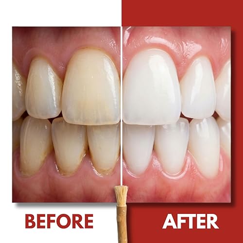SEWAK Miswak Sticks for Teeth Natural Toothbrush | مسواك | Siwak Organic Wooden Tooth Brush Oral Teeth Whitener | Vacuum Sealed (Pack of 10)