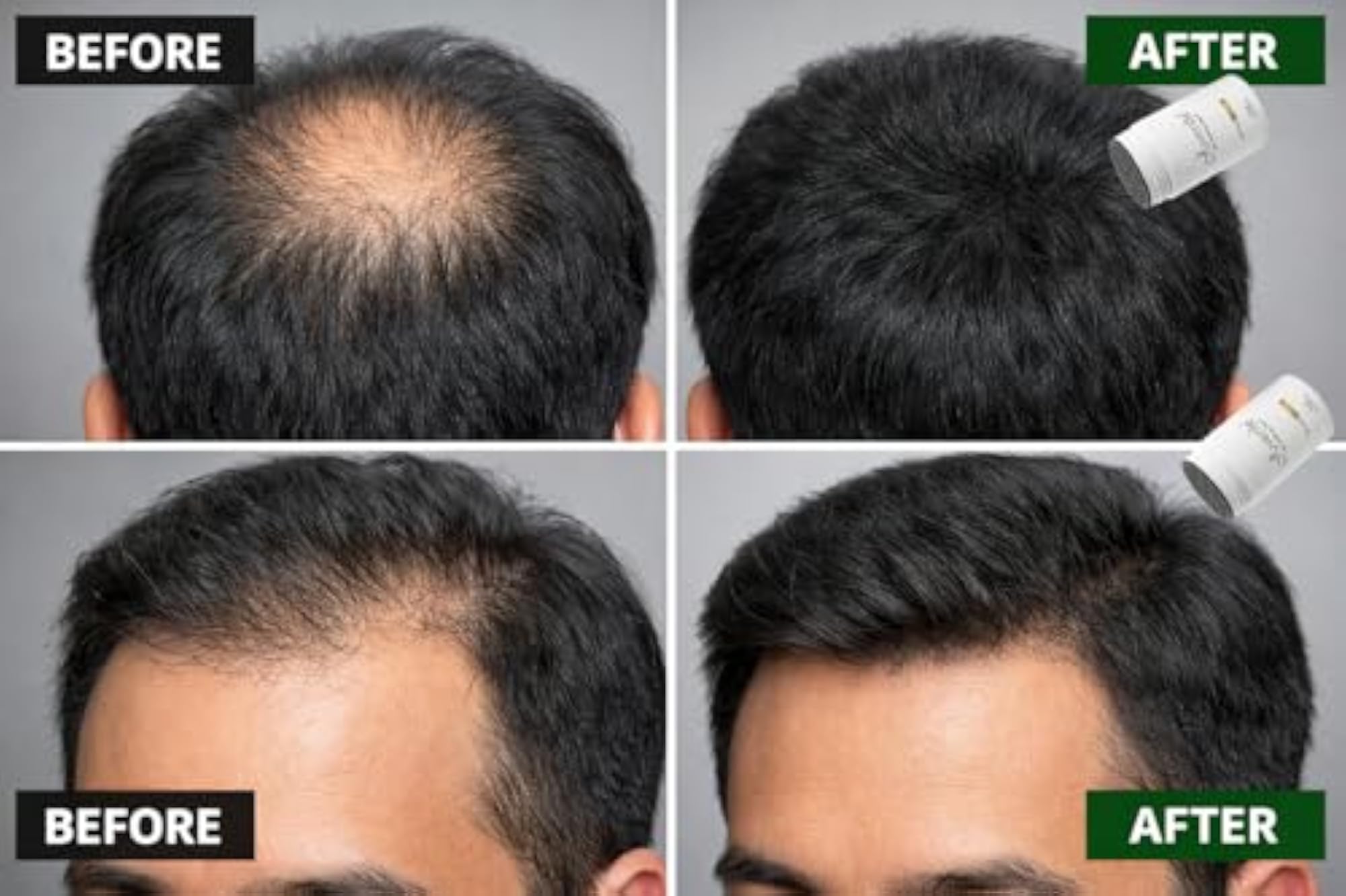 Hair Building Fiber, Black Powder Based Solution