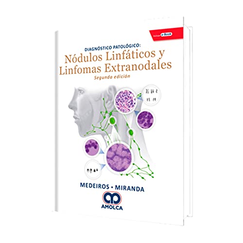 Diagnostico Patologico. Nódulos Linfaticos y Linfomas Extranodales + e