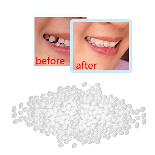 Plastic Teeth Glue Makeup Dentures Modified Temporary Filling Teeth Filling Teeth Glue Filling Holes Broken Teeth Denture Storage Case #TOP4