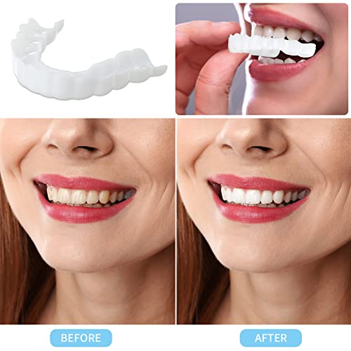 Teeth Veneers 2 Pieces Dental Veneers Fake Teeth Veneers Magic Teeth Brace Fake Top Teeth Customizable Temporary Fake Teeth White Instant Veneers Dentures With Mini Tweezer For Bad Teeth Whitening #TOP2