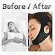 Kinnriemen Schnarchen,Kinnband Schlafapnoe,Anti Schnarchen Kinnriemen,Anti Snoring,Chin Strap Sleep für Hilfsmittel Gegen Schnarchen,Kinn Maske Zum Schlafen,Schnarchmaske,Schnarchband,Schnarchstopper