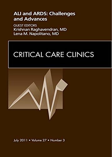 Amazon.com: Severe Acute Respiratory Distress Syndrome, An Issue of ...