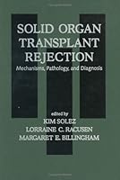 Solid Organ Transplant Rejection 0824795105 Book Cover