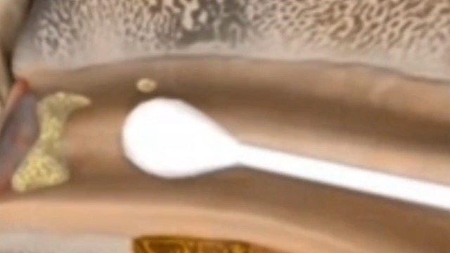 Kit Pulizia Orecchie Con Punte Spirale - Rimuove Il Cerume In Modo Sicuro E Igienico