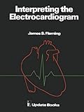 Interpreting the Electrocardiogram