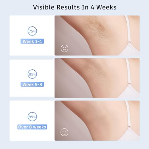 Laser Hair Removal,Laser Hair Removal for Women, 999999 Flashes,Hair Removal Device,ipl laser hair removal for Facial Legs Arms Whole Body Use (White-Rose Gold)