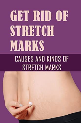 Get Rid Of Stretch Marks: Causes And Kinds Of Stretch Marks