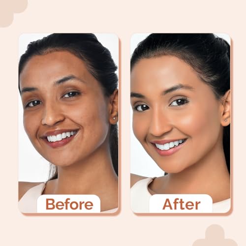 Image of The Derma Co. 1% Hyaluronic Hydrating High Coverage Foundation With SPF 40 PA+++ for 12 Hour Long Stay & 12 Hour Oil Control | For All Skin Types & Even Skin - 18ml (03 Natural, 18ML)