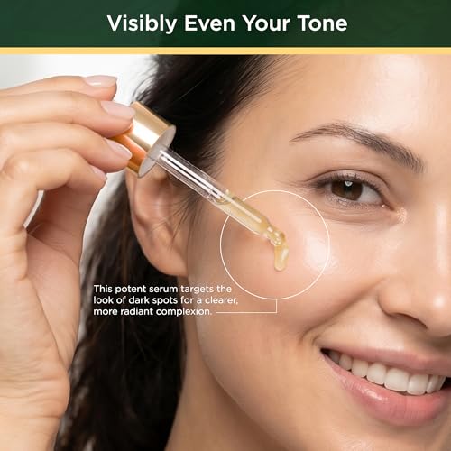 Image of Tree of Life Tranexamic Acid Serum for Face - Tranexamic Acid for Dark Spots, Dark Spot Remover for Face, Brightening Glow Serum with Niacinamide, Beginner Friendly, 1 Fl Oz