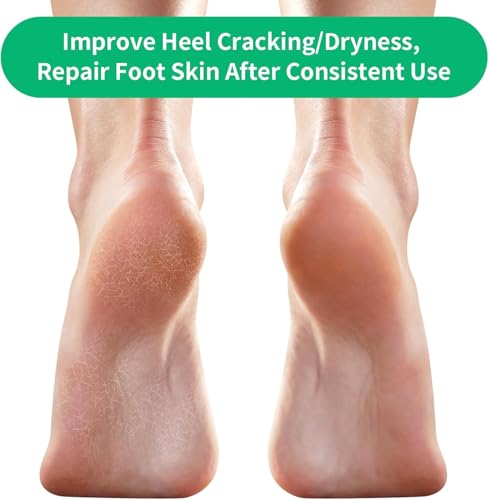 Image of UCRAVO Moisturizing Heel Socks for Women - Blue Gel Silicone Socks for Cracked Heels & Dry Feet - Soothing Hydration Gel Lining & Night Repair Sleeves
