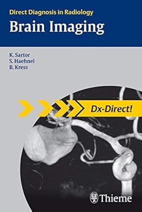 Brain Imaging: Direct Diagnosis in Radiology-Wow! eBook