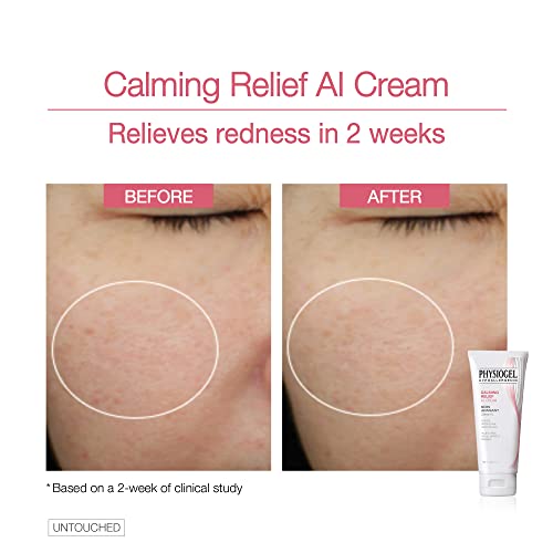 Physiogel Calming Relief A.i. Face Cream | Anti-Dryness & Itchiness Ceramide Face Moisturizer For Sensitive, Itchy, Red & Dry Skin | Soothing, Low Irritant Formula, Hypoallergenic | 3.3 Fl. Oz #TOP3