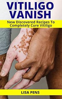 VITILIGO VANISH: Newly Discovered Secret Recipes To Completely Cure Vitiligo, Gain Your Self Esteem, Enjoy Your Clear Smooth Skin Again And Conquer Vitiligo Naturally VITILIGO VANISH: Newly Discovered Secret Recipes To Completely Cure Vitiligo, Gain Your Self Esteem, Enjoy Your Clear Smooth Skin Again And Conquer Vitiligo Naturally