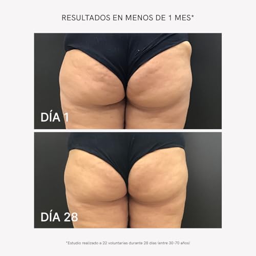 Gel Lipoventosa Anticelulítico Elimina la Piel de Naranja con Cafeína y Guaraná 500ml 4