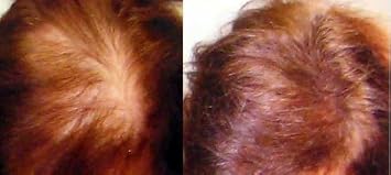 Hair Building Fibers 100% Cotton Keratin. Size 1 Pound 454g Bulk Refill Pack 60-80% SAVINGS. Compatible with Leading Brands like Cabooki & Boldify. Thinning Hair/Bald Spots Dark Brown 12g