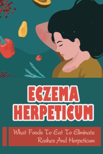 Eczema Herpeticum: What Foods To Eat To Eliminate Rashes And Herpeticum