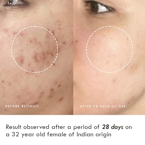 AULI LIFESTYLE Retinuit 0.3% Retinol Face Oil for Anti - Ageing, Reduce Fine Lines & Wrinkles, for Women, All Skin Type, 30ML