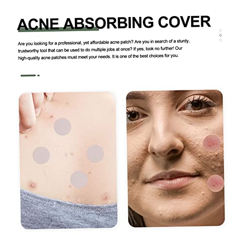 Hemoton 2 Unidades De Adesivo Invisível Para Espinhas Adesivos Para Espinhas Adesivos De Ponto Preto