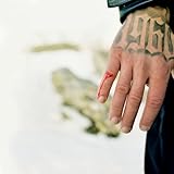 Anche a vent’anni si muore