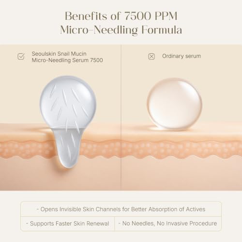Image of Seoulskin Snail Mucin Micro-needling Serum 7500 PPM - Powerful Hydration with Hyaluronic Acid & Centella Asiatica - Accelerated Rejuvenation, Cruelty-Free & Non-Comedogenic for All Skin Types
