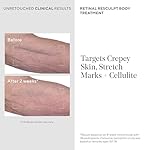 Retinal ReSculpt Body Treatment - Retinal Body Cream to Target Cellulite and Stretch Marks - Lifts, Firms, and Tightens Sagging, Crepey Skin, 5.0 Fl Oz - Image 3