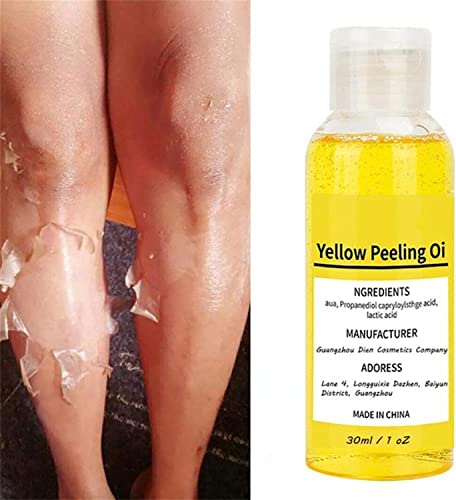 Yellow Peeling Oil,Super Strength Yellow Peeling Oil Lightening Exfoliating,Peeling Oil For Dark Skin,Lightening Exfoliating,Suit For Dark Skin,Body,Face,Dark Spots,Brightening Complexion (50Ml) #TOP5