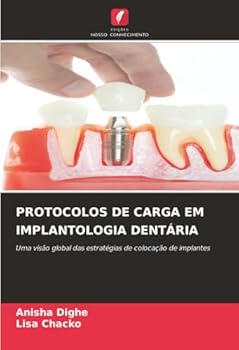 Paperback Protocolos de Carga Em Implantologia Dentária [Portuguese] Book