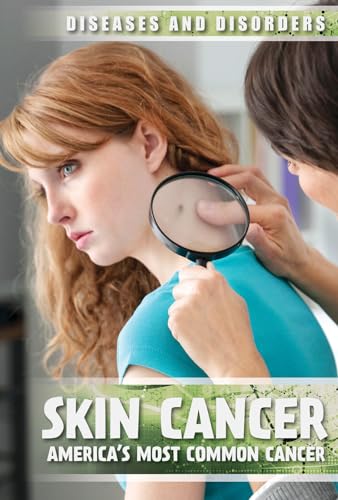 Skin Cancer: America’s Most Common Cancer (Diseases and Disorders)