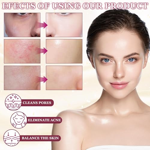 Ácido Glicólico 7% Tónico para Rostro, AHA 30% + BHA 2% Peeling Solution, Exfoliante Facial Liquido, Acido Glicolico Facial, Hidratante, Calmante, Réduit les Points Noirs,les Pores - imagen 6