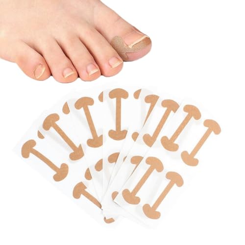 60 Pcs Ongle Incarné,Ongle Incarné Gros Orteil, Autocollants de Correction, Ongles Incarnés, Manucure, Pansement, Coton Élastique Patch d'Ongles Patch des...