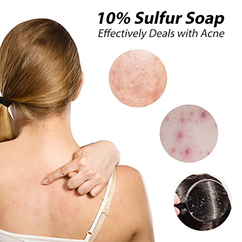 Bee & Flower Shanghai Sulfur Soap 10% Sulfur Soap Face And Body Bar Soaps 3.4 Oz (6 Packs) #TOP2