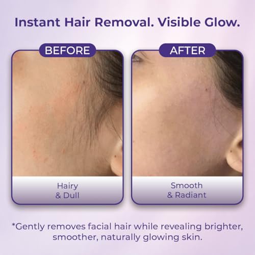 Image of Sanfe Ubtan Facial Hair Removal Cream for Women | Face Hair Remover | Upper Lip Hair Removal Cream | Chin & Forehead Hair Removal | Sensitive Skin | Gentle, Painless Formula | 50g | Pack of 1