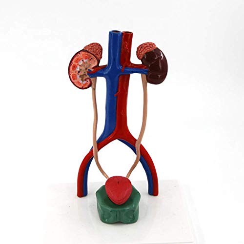 SLRMKK Modelo de Sistema urinario de 1 a 1 tamaño, vejiga arteriovenosa renal, 4 Partes, Estructura disecada del riñón, Estructura Interna de la vejiga,