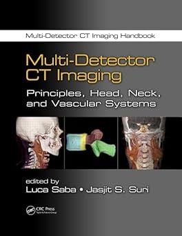 Multi-Detector CT Imaging: Principles, Head, Neck, and Vascular Systems-Wow! eBook
