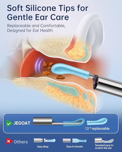 Image of Jegoat Ear Wax Removal, Ear Wax Removal Tool Camera with 1296P HD Camera and 6 LED Lights, Ear Cleaner with 10 Ear Pick, Upgraded Ear Wax Removal Kit for iOS and Android, Glossy Black