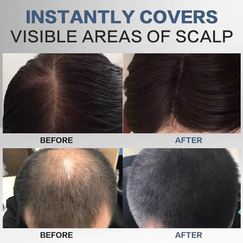 Wazdorf Store Wazdorf Cover-Up Hair Powder Black 4g - Image 4