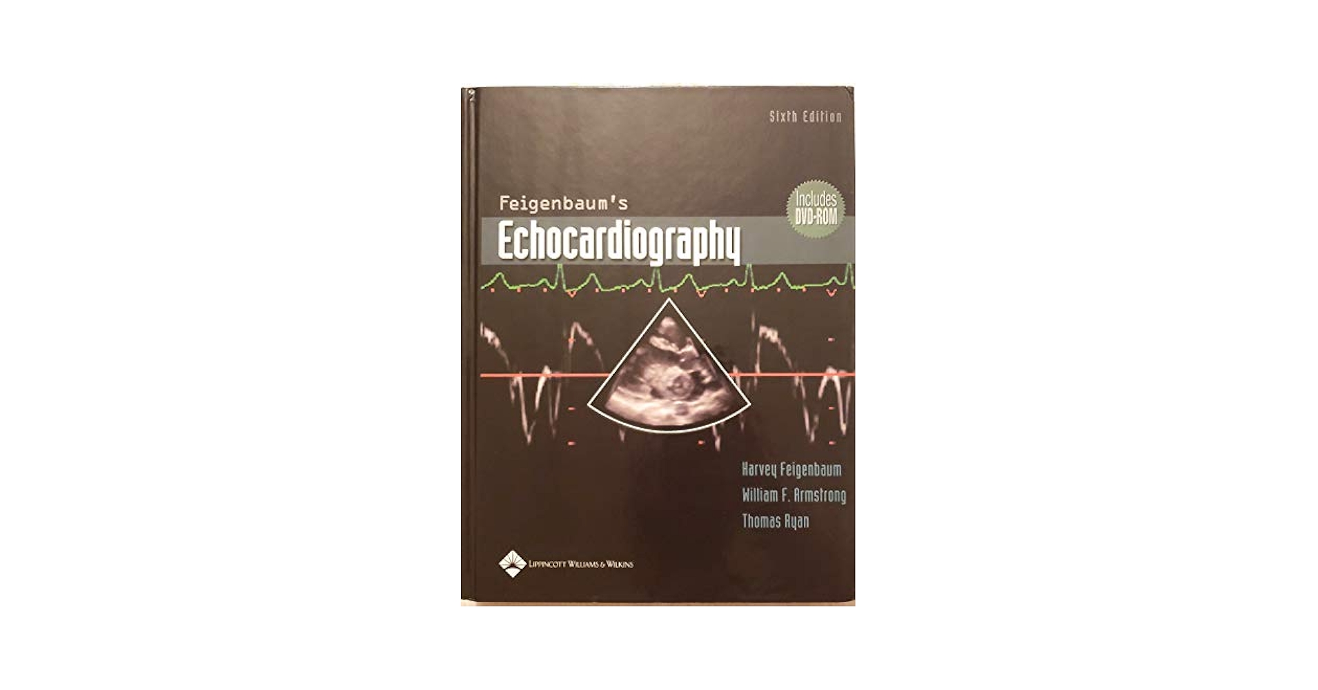 語学+参考書 Feigenbaum&#39;s Echocardiography Feigenbaum's Echocardiography: Armstrong, William F., M.D.