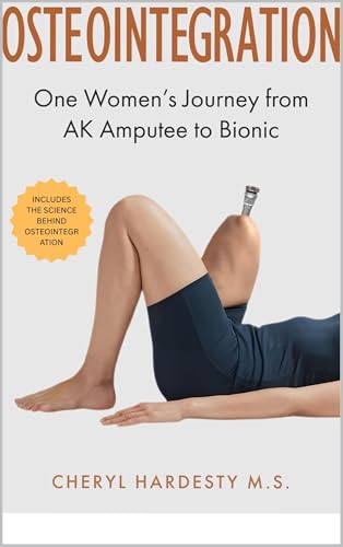 OSTEOINTEGRATION:One Women's Journey From AK Amputee to Bionic: Accompanied by the Science: An Antidote of Amputation, Prosthetics, and the studies and background of Osseointegration