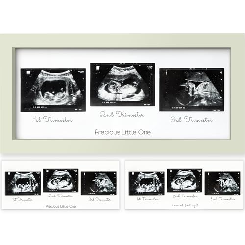 Image of KeaBabies Baby Sonogram Picture Frames - Trio Ultrasound Picture Frames, First Time Mom Gift, Cute Pregnancy Reveal Photo Frame, Baby Gender Reveal Gift, Newborn Nursery Decor (Sage)