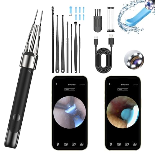 METACHOICE Ear Wax Removal Tool Camera | 2-in-1 Scoop & Tweezer 5.0MP HD Otoscope | FDA-Registered WiFi Ear Cleaner with 6 LED Lights Complete Kit for iPhone & Android