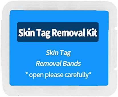 Skin Tag Removal Bands Micro Strip Skin Marks Remover Rubber Bands Non Toxic Skin Care Tools for Wart, Freckle, Nevus, Dark Spot Removal 30 Packs