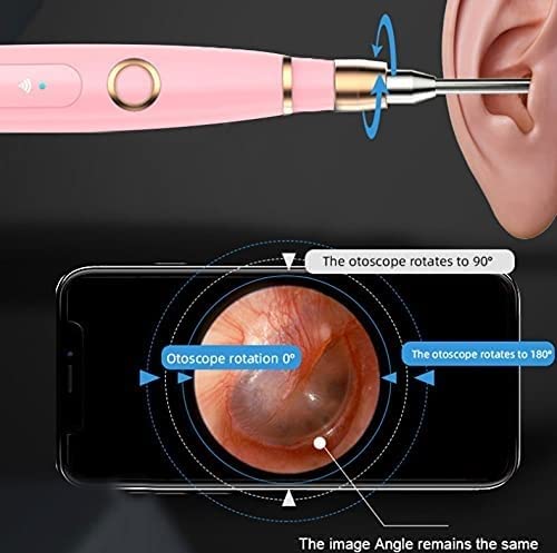 Removedor de Cera for el oído, Herramienta de eliminación inalámbrica Otoscope EARTWAX 108 0p HD Endoscopio de la Oreja con 6 LED Luz, oído Elija un oído Limpieza endocsope Kit for Adultos niños