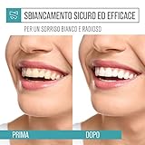 UNNIS B07B2WZ4X7 lato 4