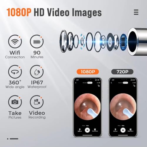 Image of Ear Wax Removal Tool Camera - Ear Cleaner with 1080P HD Camera, Otoscope with Light, Earwax Removal Kit for iPhone, iPad, Android Phones (Orange)
