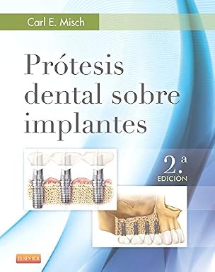 Imagen del libro Prótesis dental sobre implantes