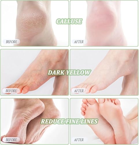 Mascarilla exfoliante para pies, 3 Pares calcetines exfoliantes de Pies, calcetines para quitar callos, calcetines hidratantes para pies, repara los talones y elimina piel seca y muerta pies suaves - imagen 5