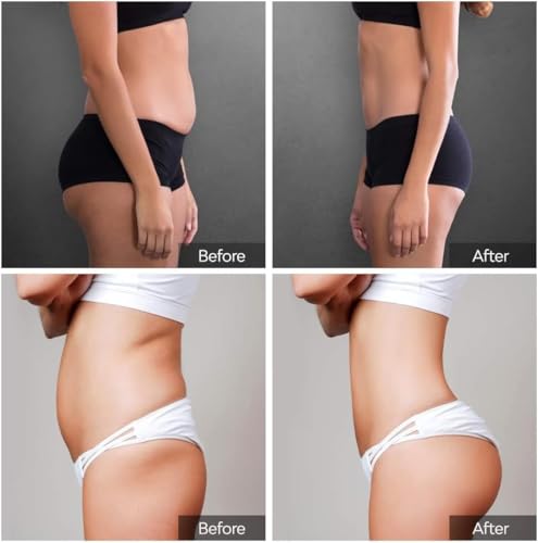 Abnehmen Patch, 50 Stück Slim Patch Fettverbrenner Pflaster, Natürliche Abnehmpflaster für schnellen Gewichtsverlust, Appetitkontrolle & Stoffwechsel-Boost, effektive Fettverbrennung