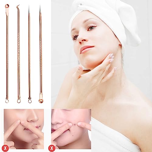 Neoreser Set di 4 Punti Neri Strumenti Rimozione